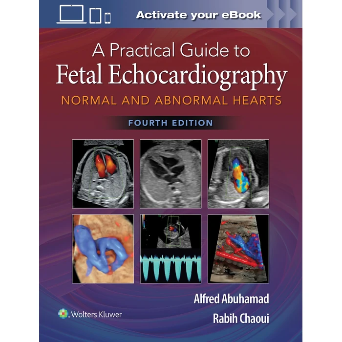A Practical Guide to Fetal Echocardiography: Normal and Abnormal Hearts by WOLTERS KLUWER HEALTH - Used - Acceptable condition - US$92.96