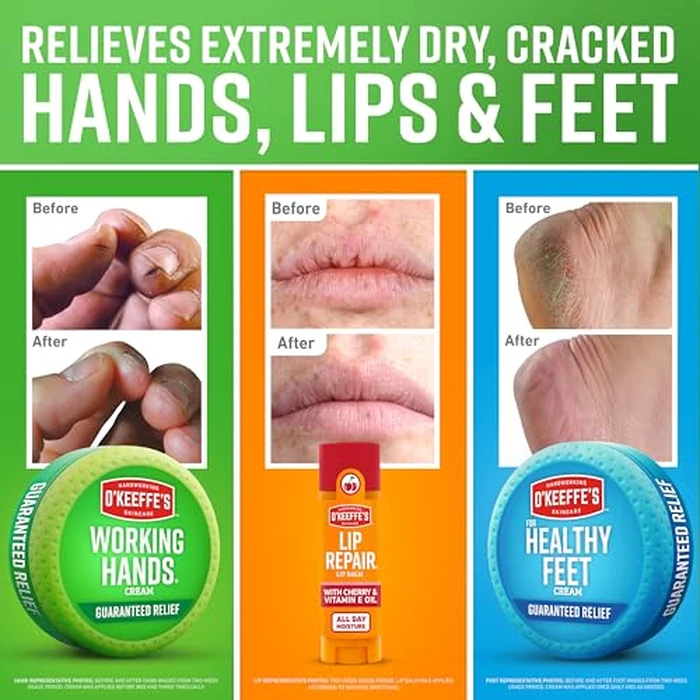 O'Keeffe's Giftbox Including Lip Repair with Cherry and Vitamin E Oil Stick, Working Hands Jar and Healthy Feet Jar, Gift Idea by O'Keeffe's - Image 3