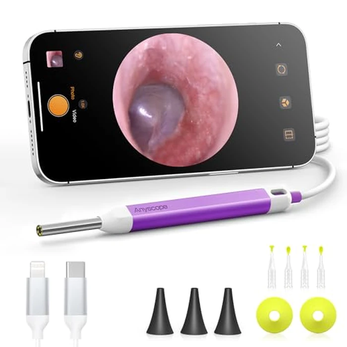 AnyScope Digital Otoscope with Gyroscope, HD Ear Camera with Ear Wax Removal Tools, Video Ear Scope Otoscope with Light, Compatible with iPhone and Android (Purple) by AnyScope - Used - Like New condition