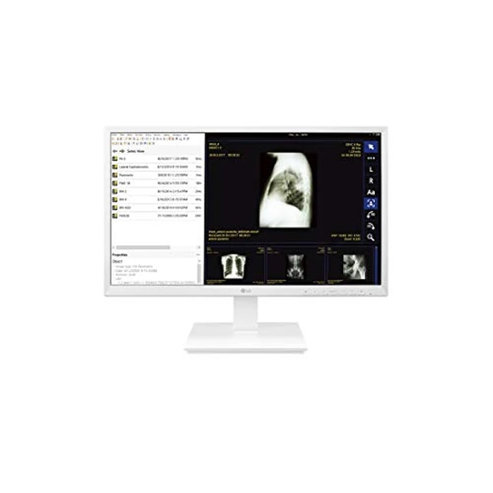 LG 24” 24CK560N-3A All-in-One FHD IPS Thin Client for Medical & Healthcare with Fanless & Ergonomic Design by LG - Used - Like New condition - US$244.99