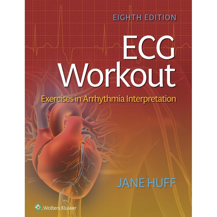 ECG Workout: Exercises in Arrhythmia Interpretation by Lippincott Williams & Wilkins - Used - Very Good condition - US$54.49