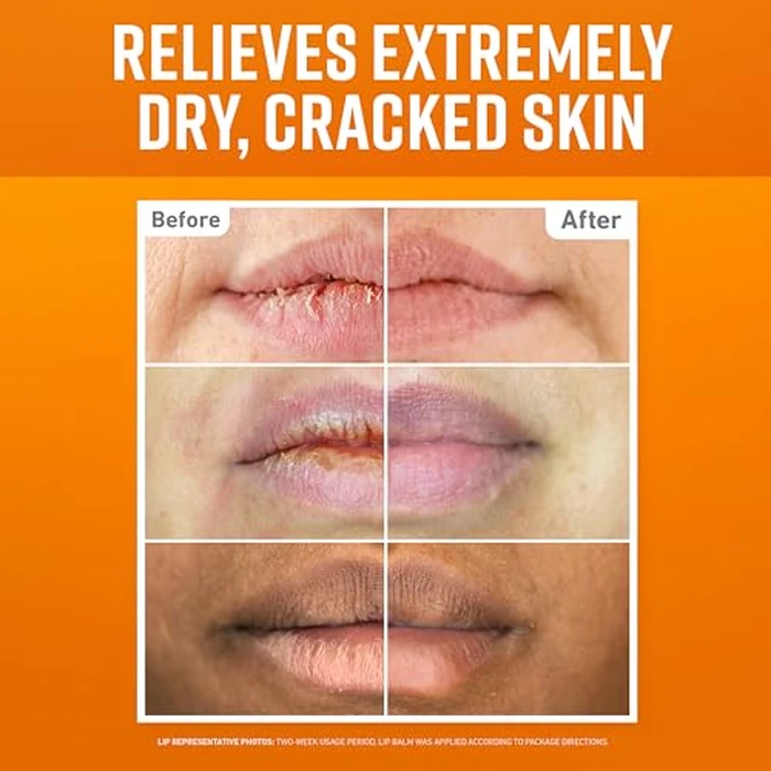 O'Keeffe's Lip Repair Lip Balm Set for Dry, Cracked Lips - Stick (Pack of 3: 1 Cooling + 1 Unscented + 1 SPF) - Moisturizer for for Extremely Cracked, Dry Lips by O'Keeffe's - Image 2