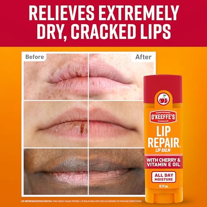 O'Keeffe's Lip Repair Lip Balm with Cherry & Vitamin E Oil - Stick (3 Pack) - Moisturizer for Extremely Cracked, Dry Lips by O'Keeffe's - Image 2
